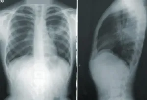 Teleradiologia – korzyści dla pacjenta i placówek medycznych